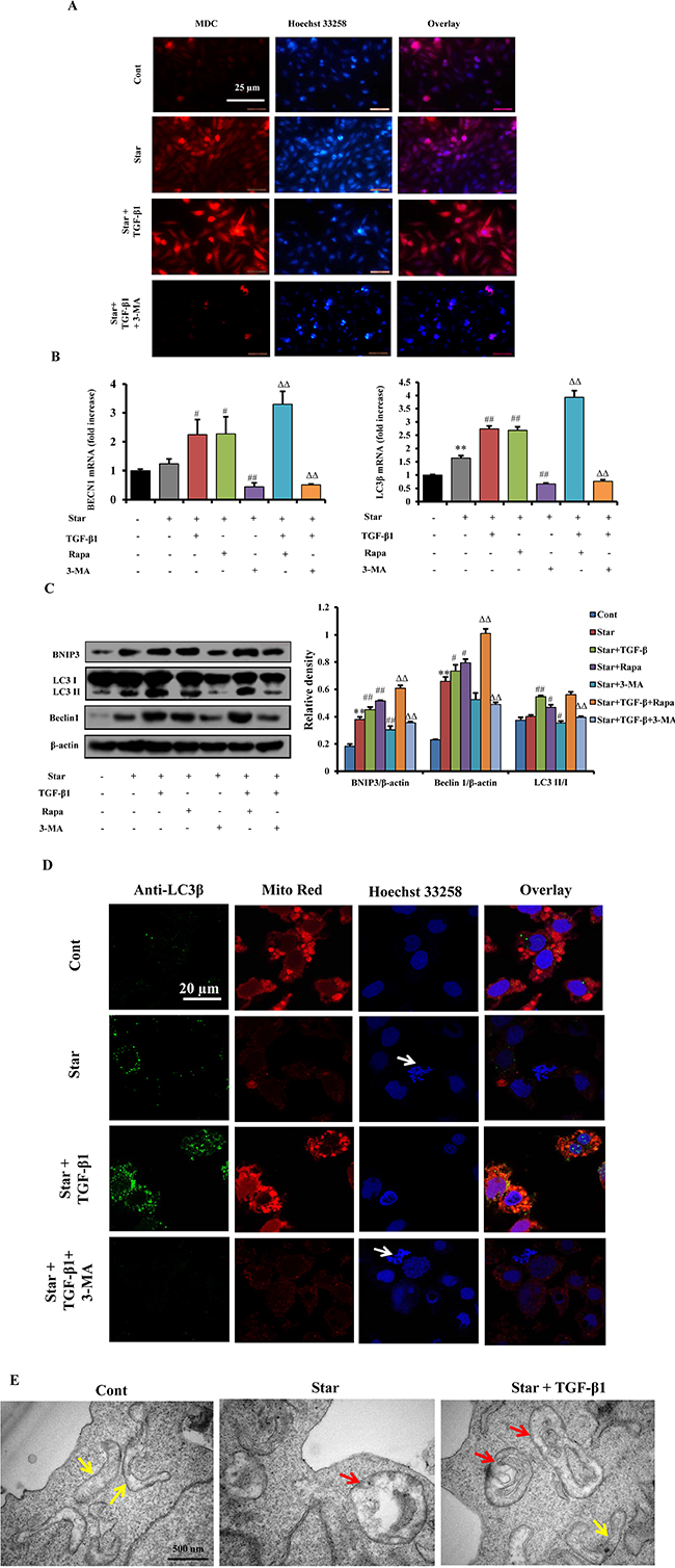 TGF-&#x03B2;1 enhanced autophagy in Star-treated NIH3T3 fibroblasts.