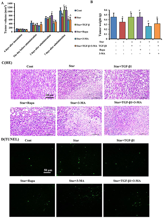 TGF-&#x03B2;1-induced autophagy promoted tumor growth of mixed xenograft tumor in Balb/c mice.