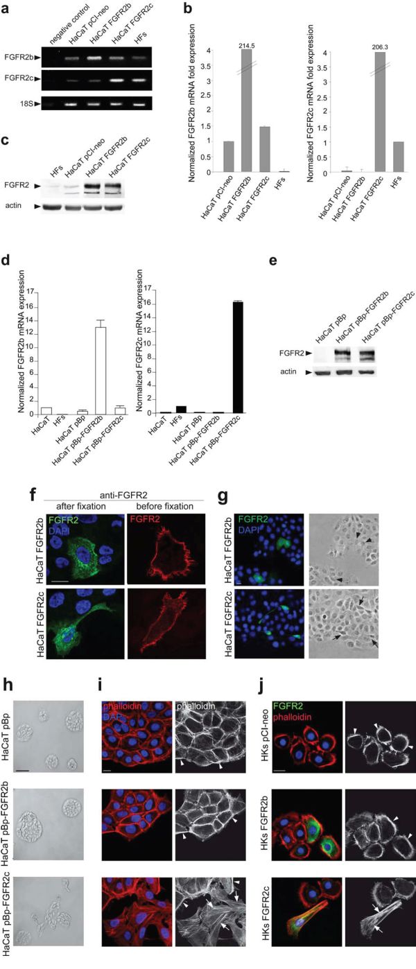 The ectopic expression of FGFR2c affects keratinocyte morphology and their growth mode.