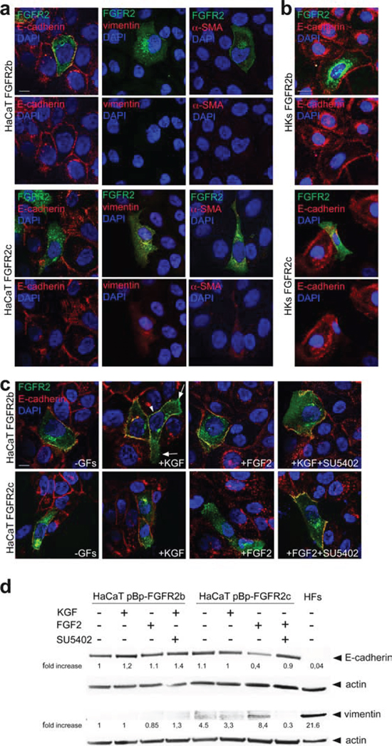 FGFR2c expression and signaling modulate epithelial and mesenchymal markers.