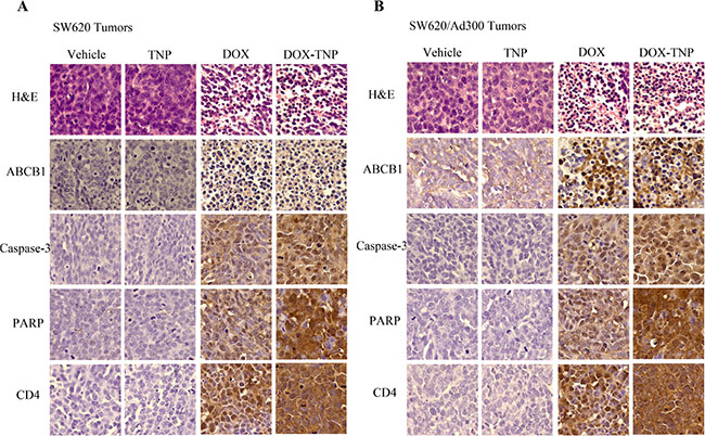 Ex vivo immunohistochemistry (IHC) analysis of SW620 tumor sections (A) and SW620/Ad300 tumor sections (B).