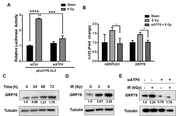 Activation of the ATF6 pathway in glioblastoma by ionizing radiation.