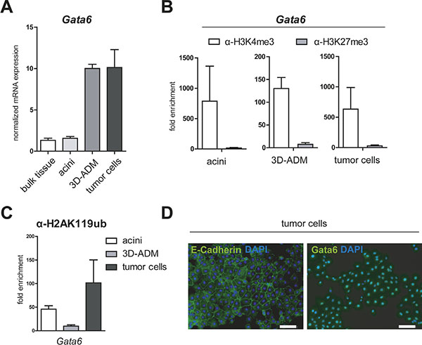 Gata6 is persistently activated in the in vitro sequence of pancreatic carcinogenesis.