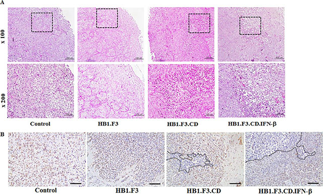 Hematoxylin and eosin (H &#x0026; E) staining and PCNA expression level in metastatic breast cancer models.