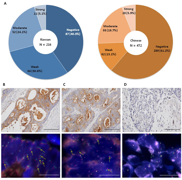 The prevalence of TrkA protein expression in Korean and Chinese patients with colon cancer.