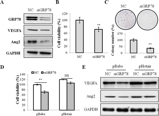 GRP78 knockdown suppressed cell viabilities and angiogenesis in NPC cells.