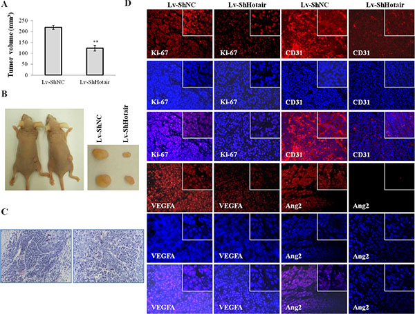 Hotair knockdown reduced tumorigenicity and angiogenesis in nude mice.