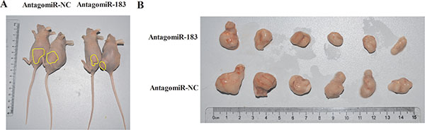 AntagomiR-183 inhibited colon tumor growth in vivo.