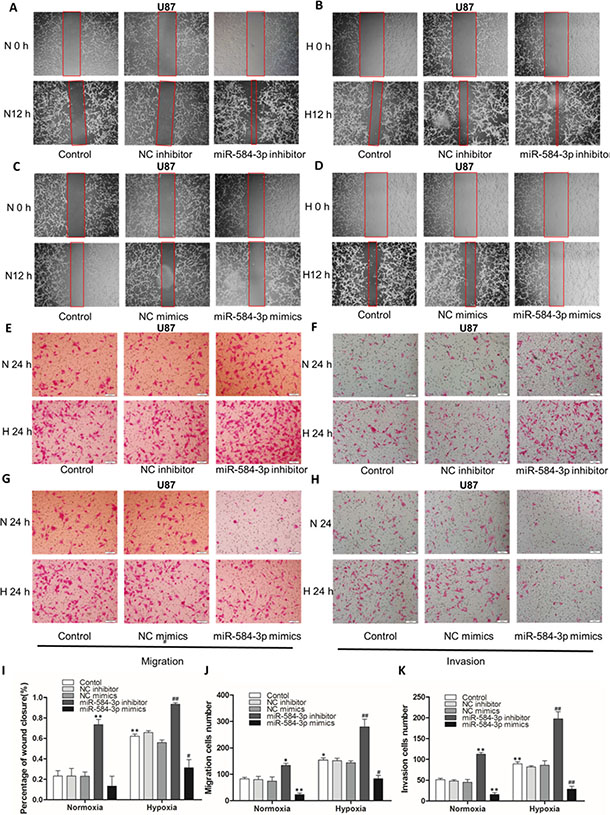 miR-584-3p knockdown enhanced the migratory and invasive capacities of human glioma cells and miR-584-3p overexpression suppressed the migratory and invasive capacities of human U87 glioma cells.