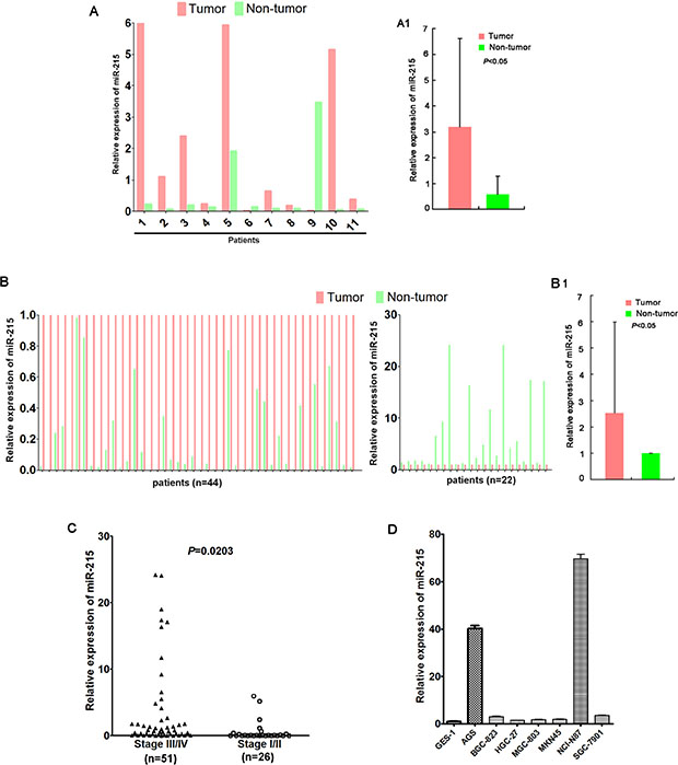 miR-215 expression was frequently up-regulated in GC.