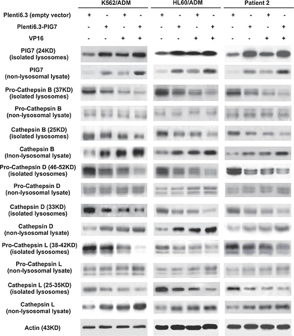 Effect of pig7 on the expression and cytosolic release of cathepsins in leukemia cells, when comparing isolated lysosomes and non-lysosome-containing lysate.