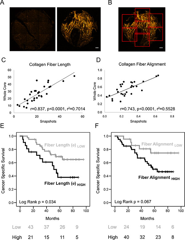 Fully automated measurement of collagen fiber morphology shows increased length correlates with poor prognosis.