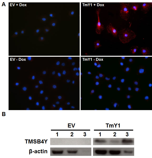 TMSB4Y interacts with &#x3b2;-actin.