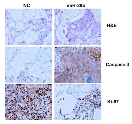 In vivo analysis of miR-29b-effects in the SCID-synth-hu model.