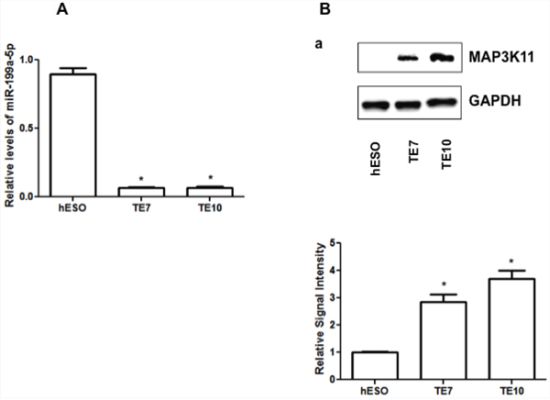 Baseline miR-199a-5p and MAP3K11 protein expression levels in human esophageal cell lines.