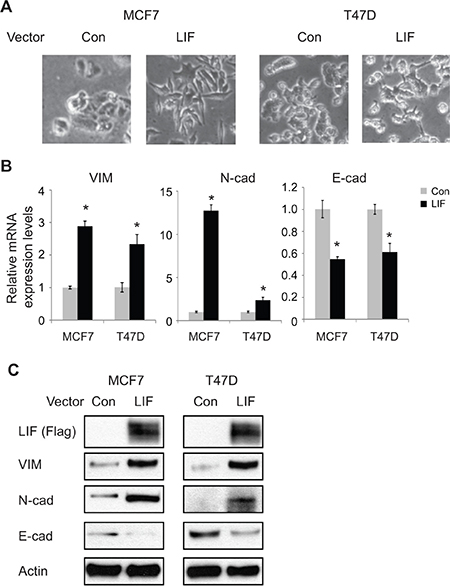 Ectopic expression of LIF induces EMT in MCF7 and T47D cells.