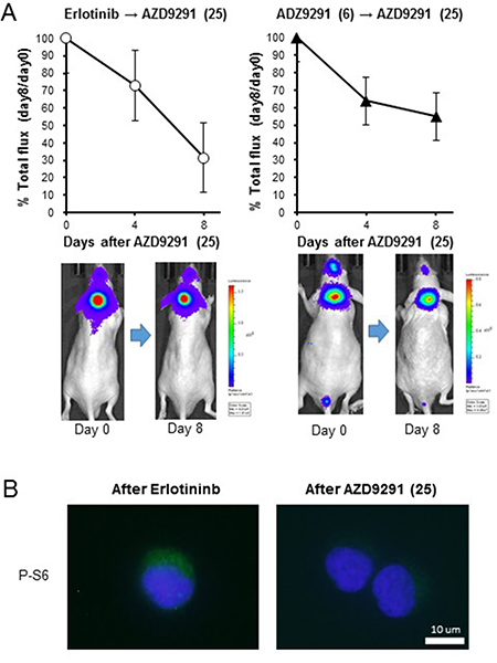 Effect of high dose-AZD9291 treatment after acquisition of EGFR-TKI resistance.