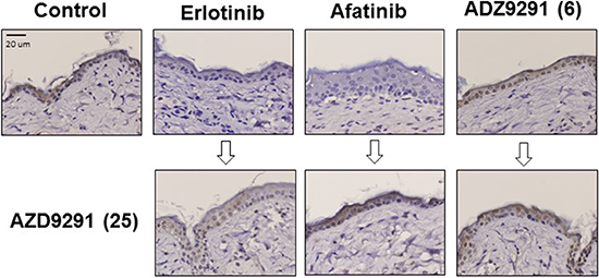 The effect of continuous EGFR-TKI treatment on MAPK phosphorylation in normal skin cells.