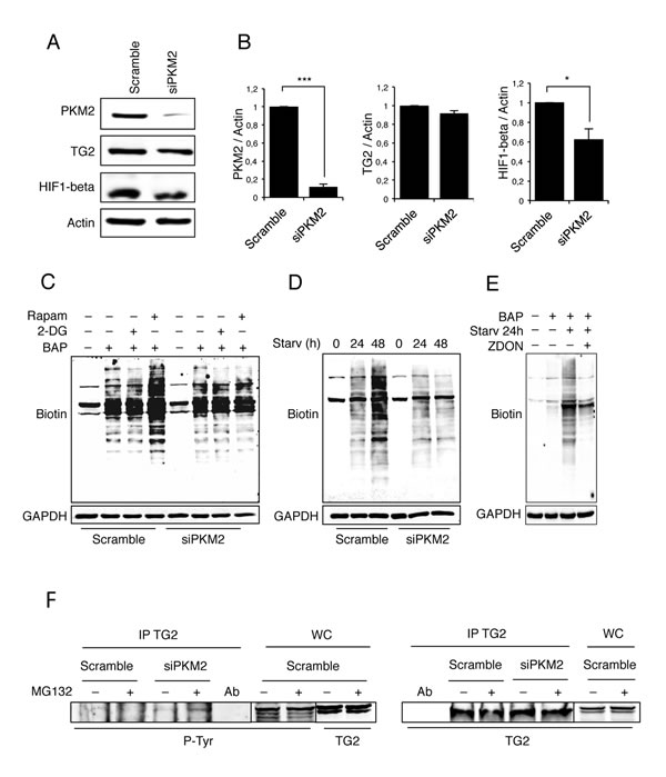 Analysis of TG2 transamidating activity and PKM2 protein expression levels.