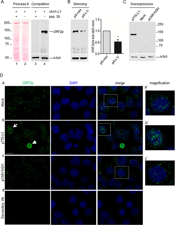 chA1-L1 monoclonal antibody specifically recognizes both endogenous and overexpressed ORF2p in A-375 melanoma cells.