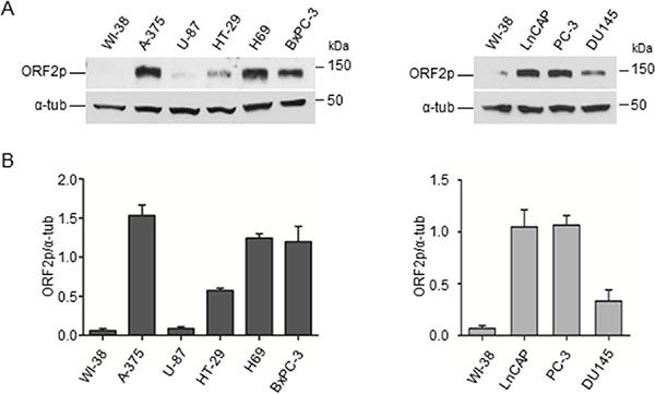 Detection of ORF2 protein in human cancer cell lines.