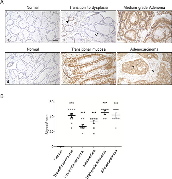 Immunohistochemical staining of ORF2p in human colon tissue sections.