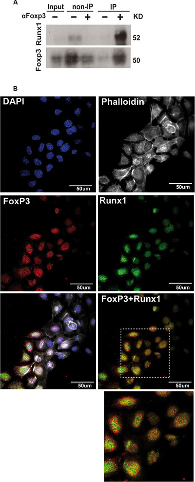 Runx1 physically interacts with Foxp3 in normal mammary epithelial cells.