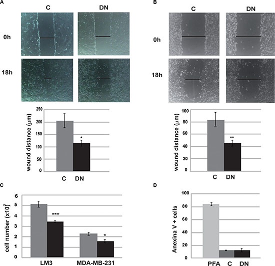 Runx1 is required for tumor cell migration.