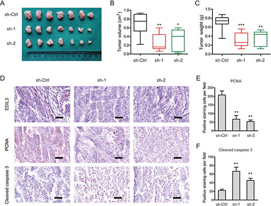 Knockdown of EDIL3 attenuates tumor growth in vivo.