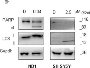 Autophagy activation is an early event in ALKF1174L mutated cells.