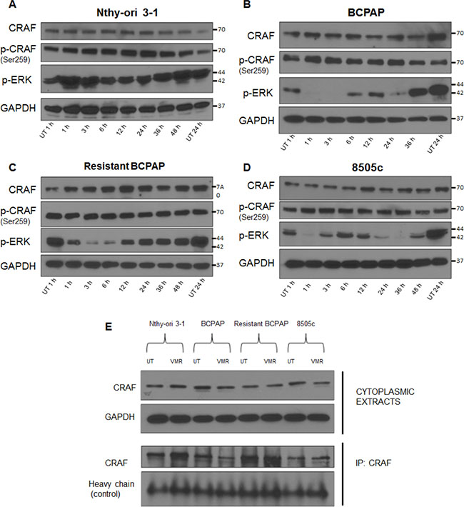 Resistant BCPAP cells do not exhibit oscillatory inhibition of phospho-ERK and have increased CRAF dimers.