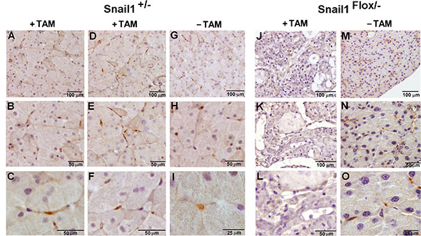 Snail1 is expressed in mesenchymal cells in the pancreas.