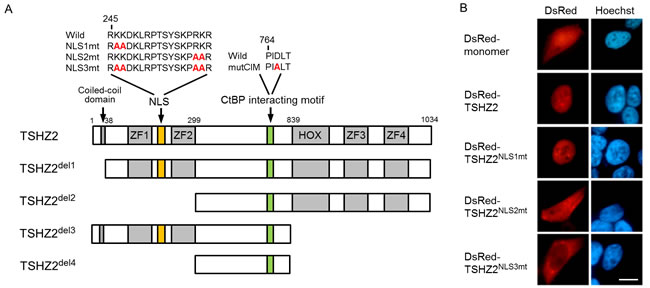 TSHZ2 is a nuclear protein.