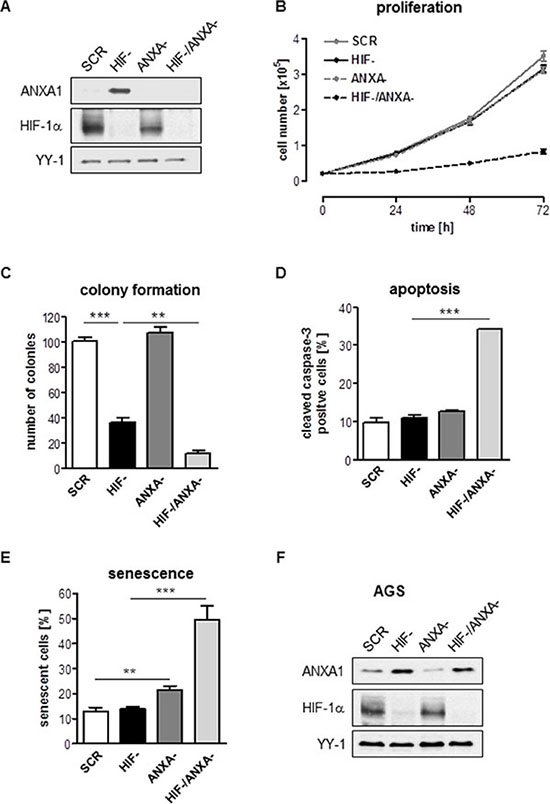 Effects of combined inhibition of HIF-1&#x03B1; and ANXA1 on AGS cell proliferation.