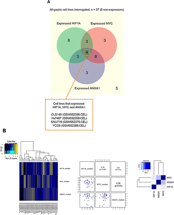 Comparative analysis of HIF1A, ANXA1 and MYC expression in gastric cancer cell lines.