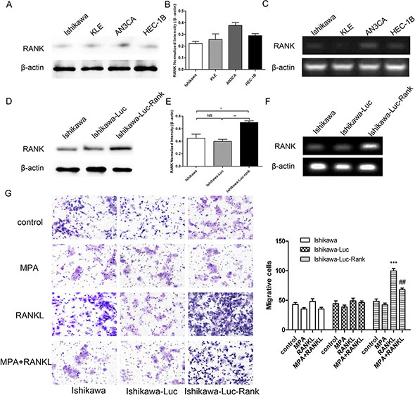 RANK promotes migration, invasion of EC cells.