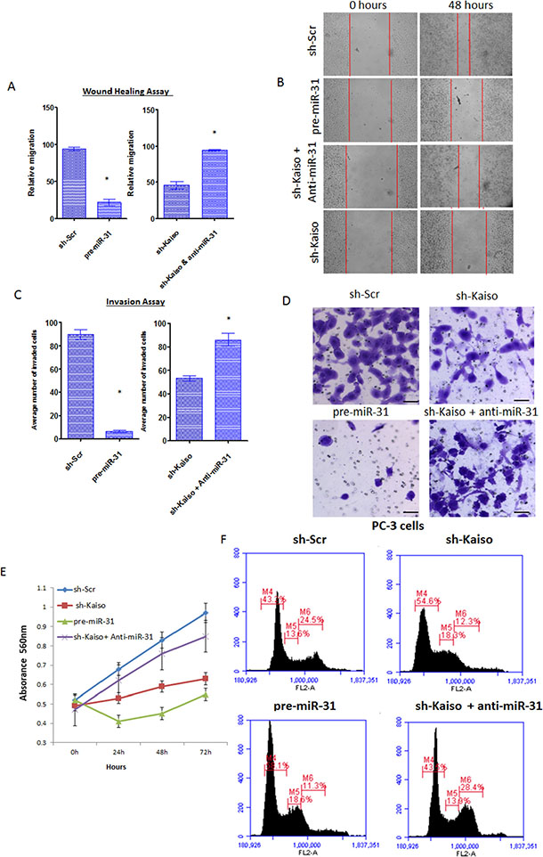 Kaiso regulates cell proliferation, migration and invasiveness, at least in part, through miR-31.