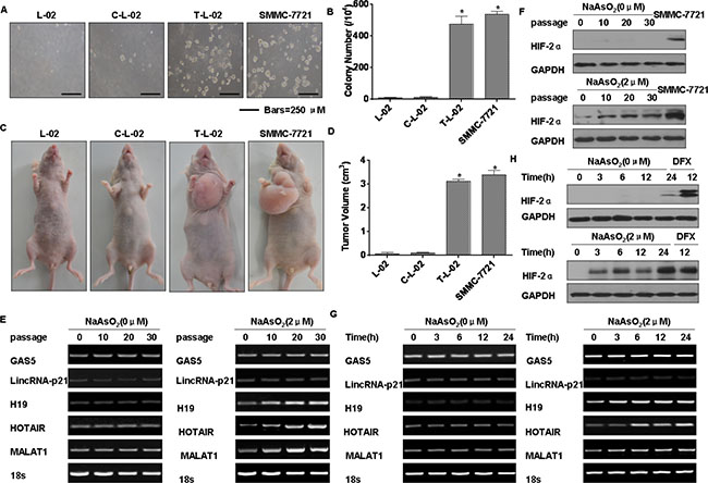 Arsenite-induced neoplastic transformation has effects on the levels of lncRNAs and HIF-2&#x03B1; in L-02 cells.