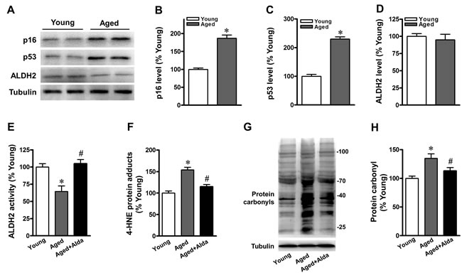 Aged mice show reduced cardiac ALDH2 activity and increased protein carbonyls.