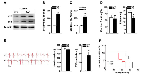 ALDH2 knockout mice display senescent-like features and show impaired heart function.