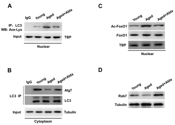 ALDH2 activation facilitates deacetylation of LC3 and FoxO1.
