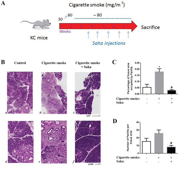 Cigarette smoke exposure stimulates pancreatic lesion formation and HDAC inhibition prevents this effect in KC mice.