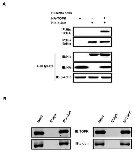 TOPK binds directly to c-Jun in lung cancer cells.