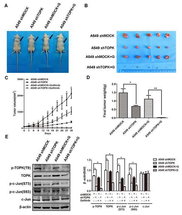 Knockdown of TOPK increases the responsiveness of human xenograft lung adenocarcinoma to gefitinib.