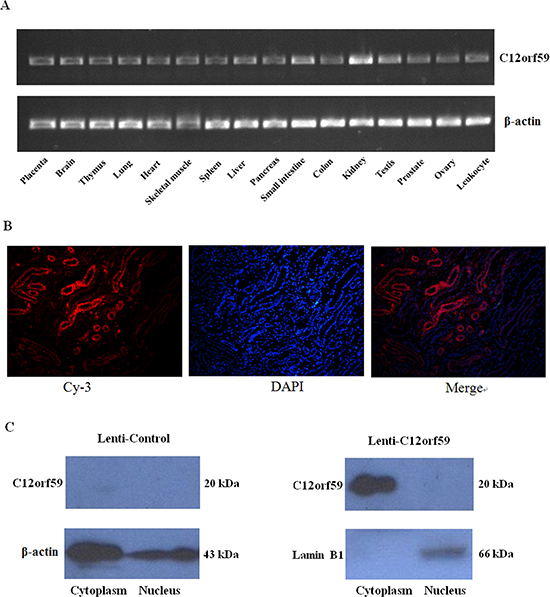 Tissue distribution of C12orf59 mRNA expression and subcellular localization of the C12orf59 protein in kidney tissues.