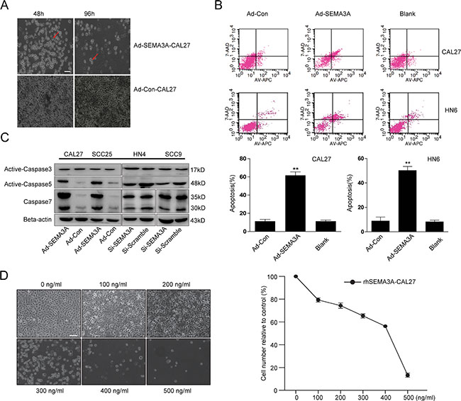 SEMA3A over-expression induces apoptosis in HNSCC cells in a caspase-dependent manner.