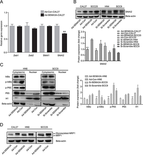 SEMA3A-mediated reversion of EMT was associated with the inhibition of NF-&#x03BA;B-SNAI2 pathways.