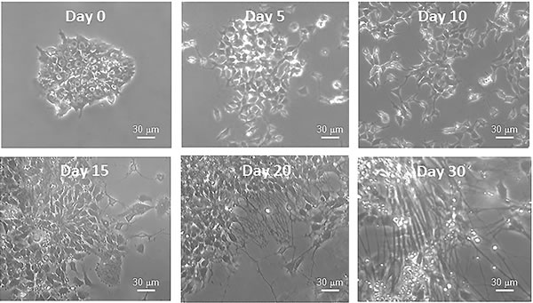 Figure 4 : Bright field photographs of iPSCs before (Day 0) and during differentiation (Days 5, 10, 15, 20, 30) into neurons.