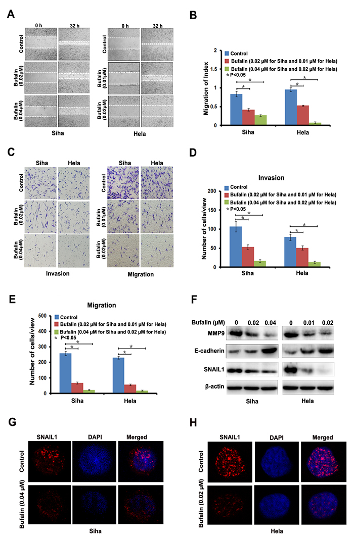 Bufalin suppressed cervical cancer cell migration and invasion by regulating EMT-associated proteins.