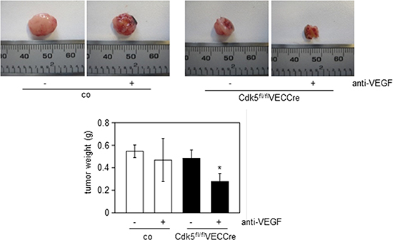 Cdk5 inhibition sensitizes to anti-angiogenic treatment.